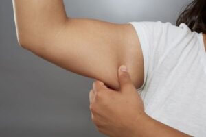 Reduce Arm Fat