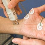 الکترومیوگرافی (EMG)