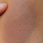 رنگ های کبودی به چه معناست؟