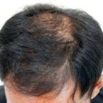 How to get thicker hair