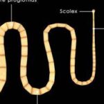 Everything you need to know about tapeworms