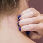 با خارش گردن چه کنیم؟