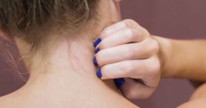 با خارش گردن چه کنیم؟