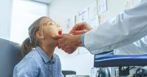 How to Treat and Prevent Conditions of the Lingual Frenulum