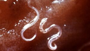 Intestinal worms in humans and their symptoms