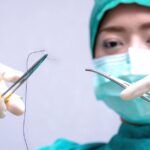 هر آنچه که باید در مورد بخیه های جراحی بدانید