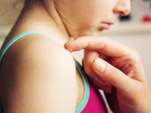 زونا مسری و چگونه می تواند گسترش یابد.line.comhttps://www.healthline.com › سلامتی