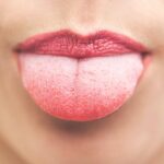 برجستگی دروغ (پاپیلیت گذرا زبانی)healthline.comhttps://www.healthline.com › سلامتی
