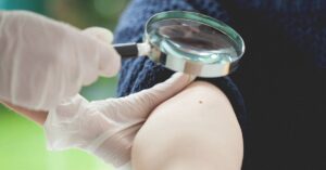 هاله خال یا خال: علائم، علل، تشخیص و ...healthline.comhttps://www.healthline.com › سلامتی