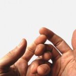دست‌های متورم: ورزش، علل دیگر و درمان.