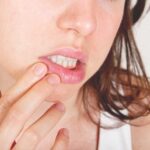 شیلیت زاویه ای: علائم، علل، درمان shealthline.comhttps://www.healthline.com › سلامتی