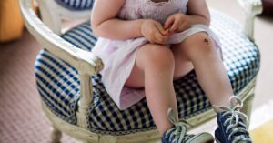 دلمه زرد: علل، ظاهر و درمان Optionshealthline.comhttps://www.healthline.com › سلامتی