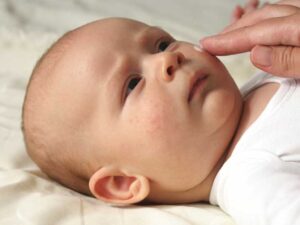 کراتوز پیلاریس (پوست مرغ)healthline.comhttps://www.healthline.com › سلامتی