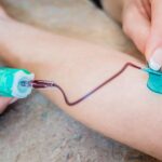 سوزن پروانه ای برای کشیدن خون: چگونه کار می کند و چرا ...healthline.comhttps://www.healthline.com › سلامتی