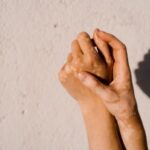 7 دلیل ممکن است رنگدانه پوست شما تغییر رنگ دهد