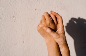 7 دلیل ممکن است رنگدانه پوست شما تغییر رنگ دهد