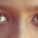 Eyelid Dermatitis: Treatments, Symptoms, Causes, and Morehealthline.comhttps://www.healthline.com › health