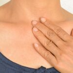 خارش قفسه سینه: علل، علائم و درمان shealthline.comhttps://www.healthline.com › سلامتی