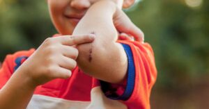 چگونه از برداشتن دلمه دست برداریم و Scarshealthline.com را درمان کنیمhttps://www.healthline.com › سلامتی