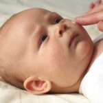 کراتوز پیلاریس (پوست مرغ)healthline.comhttps://www.healthline.com › سلامتی