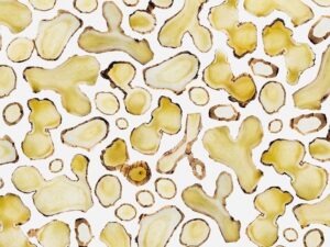 10 درمان خانگی برای درد قلبmedicalnewstoday.comhttps://www.medicalnewstoday.com › ...