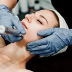 آیا میکرودرم ابریژن برای آکنه موثر است؟
