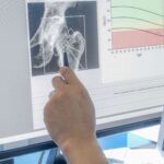 پوکی استخوان چگونه تشخیص داده می شود؟