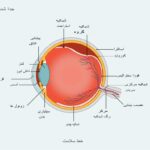 جداشدگی شبکیه در چشم چیست؟