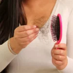 Can Diabetes Cause Hair Loss? Top Doctors Reveal Causes and Easy Remedies