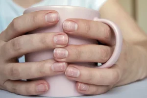 ۹ علت شایع برای ایجاد لکه‌های سفید روی ناخن