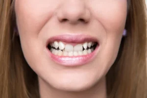ده راه برای تسکین زخم معده در خانه