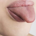 دلیل که می‌تواند باعث تورم زبان شود rdiet.ir