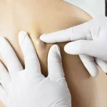 چرا کیست‌های چربی تشکیل می‌شوند و اگر یکی از آنها ترکید چه باید کرد؟ rdiet.ir
