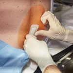 ۱۶ کیست به همراه تصاویر برای کمک به شناسایی آنها rdiet.ir