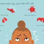 چه چیزی باعث ایجاد لکه قرمز روی چشم شما می‌شود؟ rdiet.ir