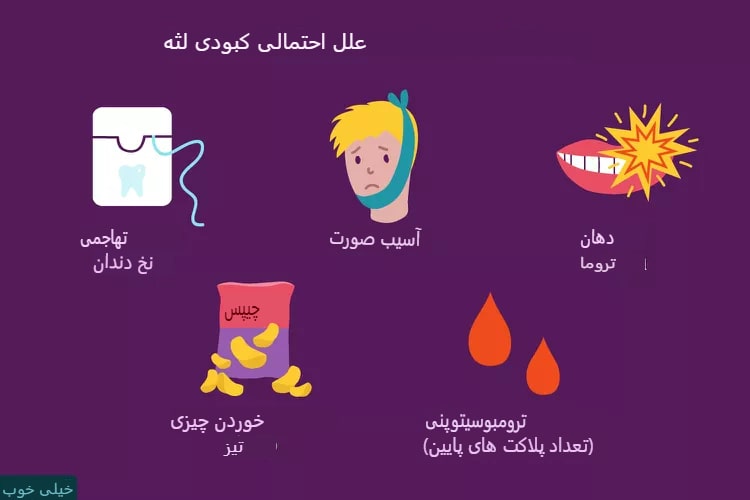 علت کبودی لثه و روشهای درمان آن
