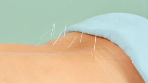 استئووژنز ایمپرفکتا