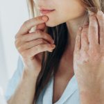 https://www.everydayhealth.com/skin-conditions/psoriasis-and-bipolar-disorder/