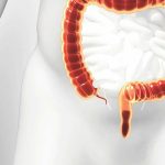 آپاندیس چه کاری انجام می‌دهد؟ rdiet.ir