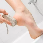 راهکارهای حذف میخچه برای کاهش درد و فشار
