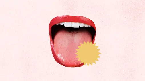 چه چیزی باعث درد زبان پس از خوردن میوه میشود؟