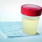اوروفلومتری چیست و چه انتظاری از آن باید داشت؟
