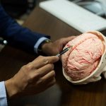 آنچه باید درباره تحریک عمقی مغز (DBS) بدانید