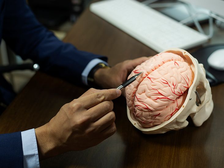 آنچه باید درباره تحریک عمقی مغز (DBS) بدانید