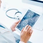 تغییر از ام‌اس عودکننده-فروکش‌کننده به ام‌اس پیشرونده ثانویه