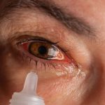 بهترین قطره‌های چشمی برای چشم صورتی (التهاب ملتحمه)