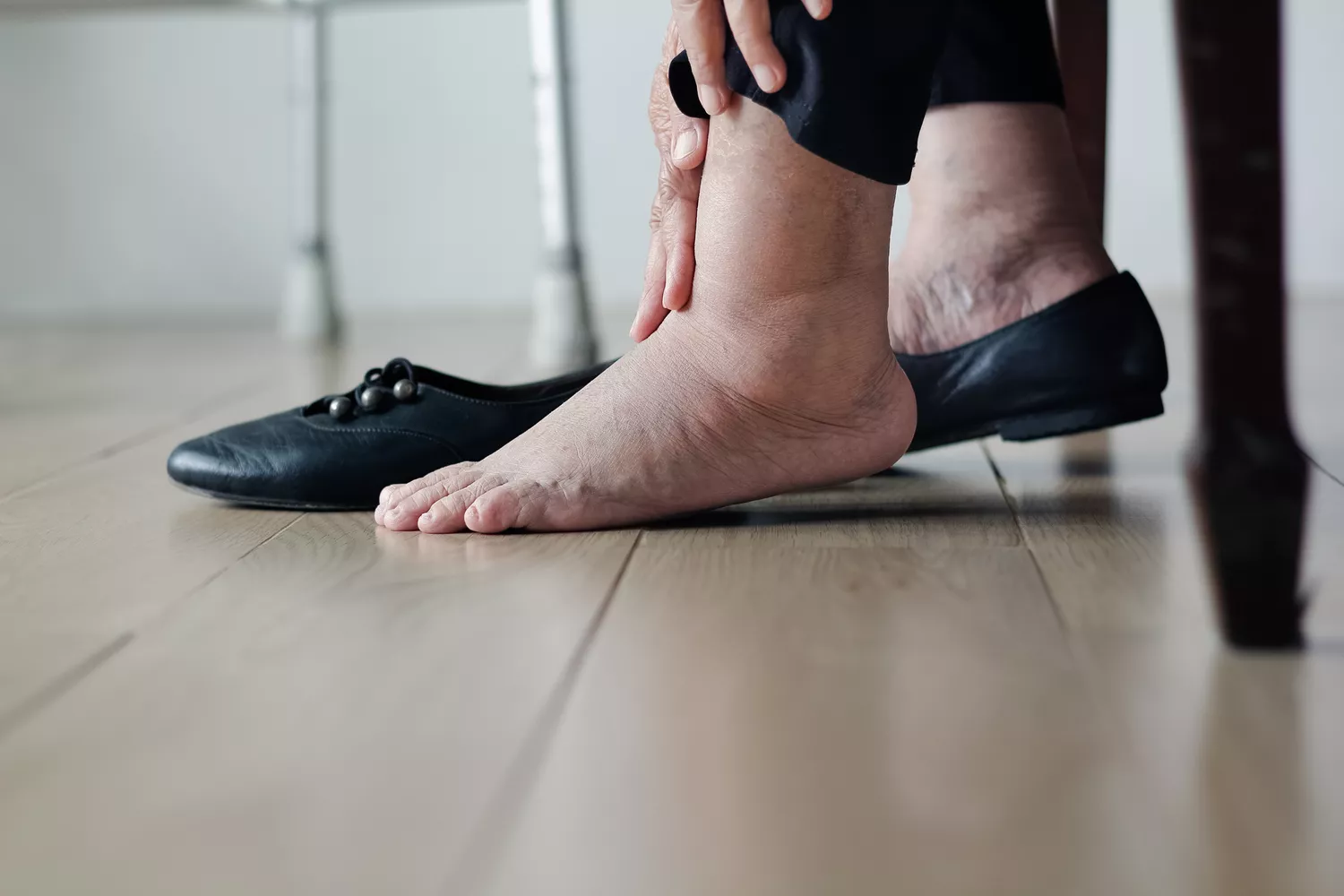 آیا مچ پای شما شکسته است یا پیچ خورده؟