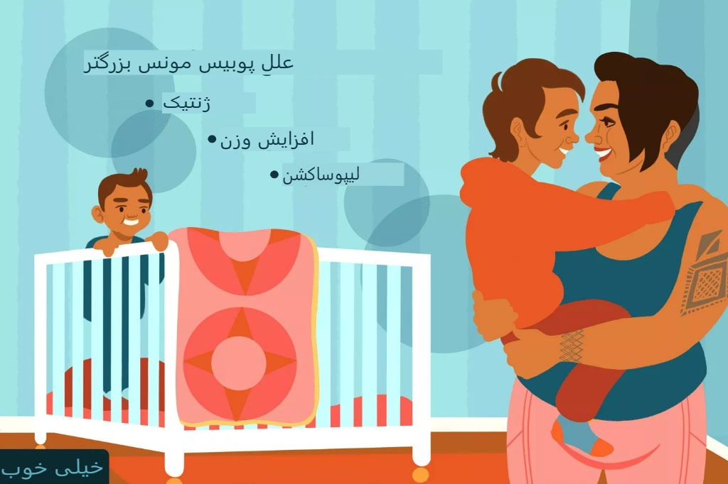 روشهای کاهش چربی در ناحیه فوقانی شرمگاهی (FUPA)