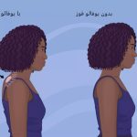 راهنمای خلاص شدن از قوز بوفالو (تجمع چربی پشتی گردنی)