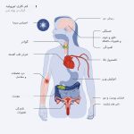 بررسی ارتباط کم‌کاری تیروئید و افزایش کبودی